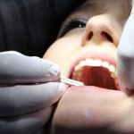 Kort verzuimverlof: geef je als werkgever betaald vrij voor een bezoek aan de tandarts?
